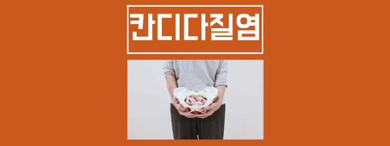  칸디다 질염 원인 증상