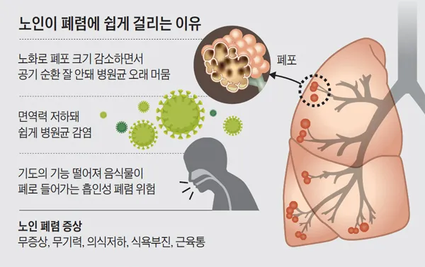 폐렴 초기증상