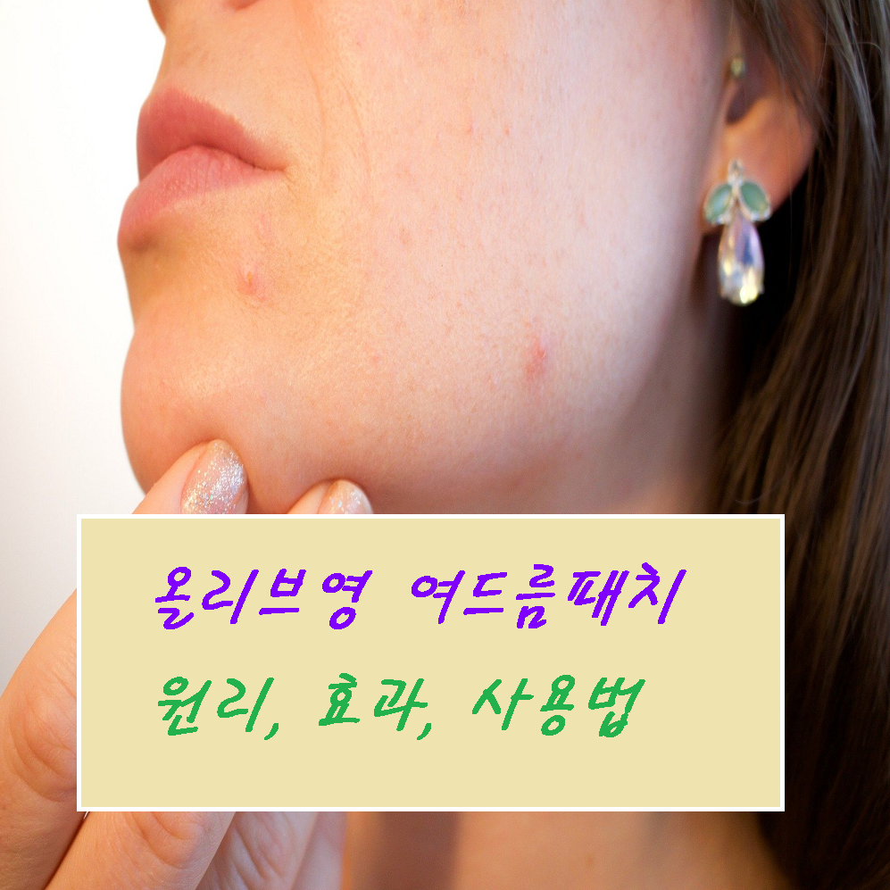  약국 올리브영 여드름 패치 원리! 흉터 치료에 효과적인 사용법!