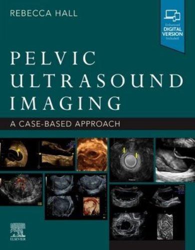 Pelvic Ultrasound Imaging,1/e