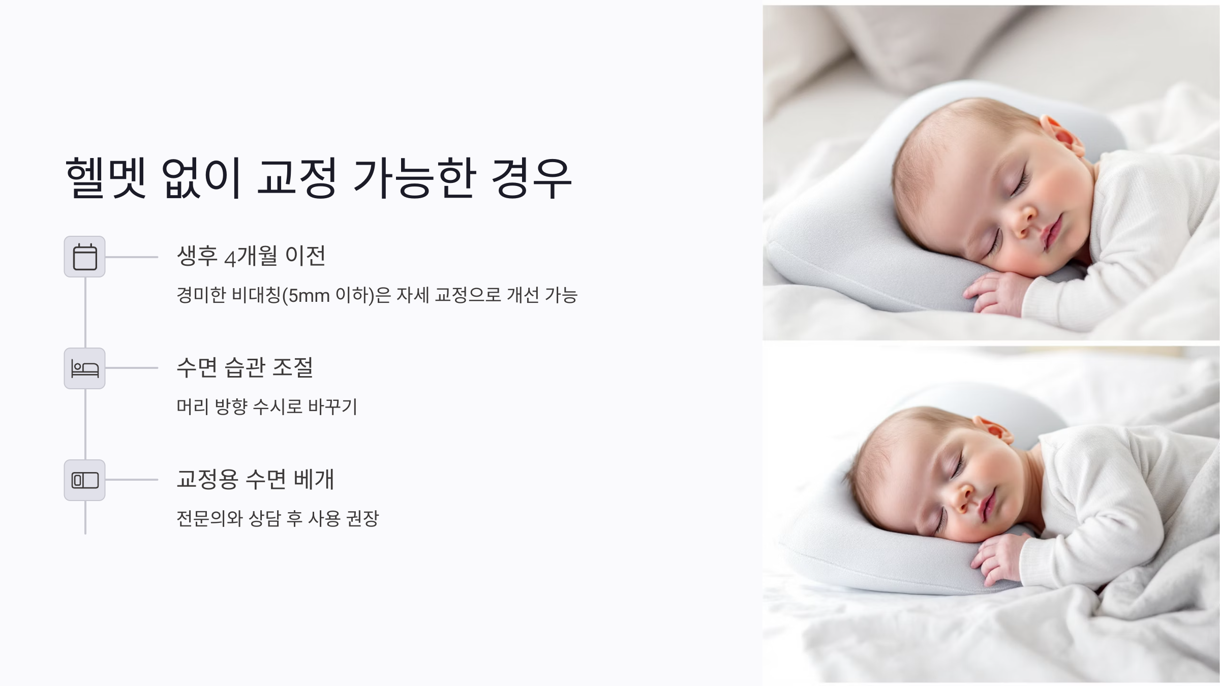 신생아 두상 헬멧 없이 교정 가능한 경우는?