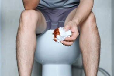  가끔씩 나를 놀라게하는 혈변의 원인과 증상, 대처방법은?