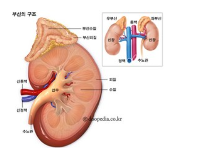 부신 종양의 진단과 치료