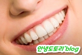 라미네이트 란?