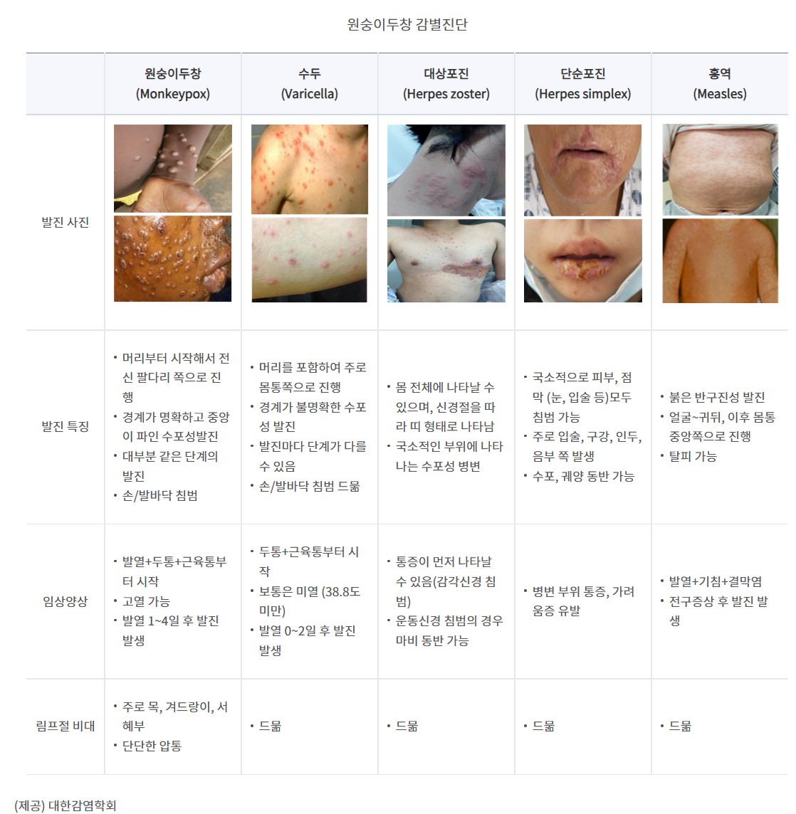  한달만에 3천백여명???WHO 비상사태논의한다?(Ft.원숭이두창)