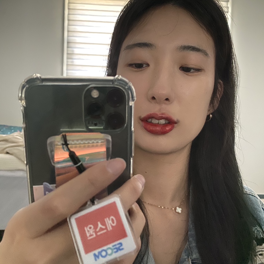 입술 보톡스 부작용 대전 입술필러+입꼬리보톡스 내돈내산 5