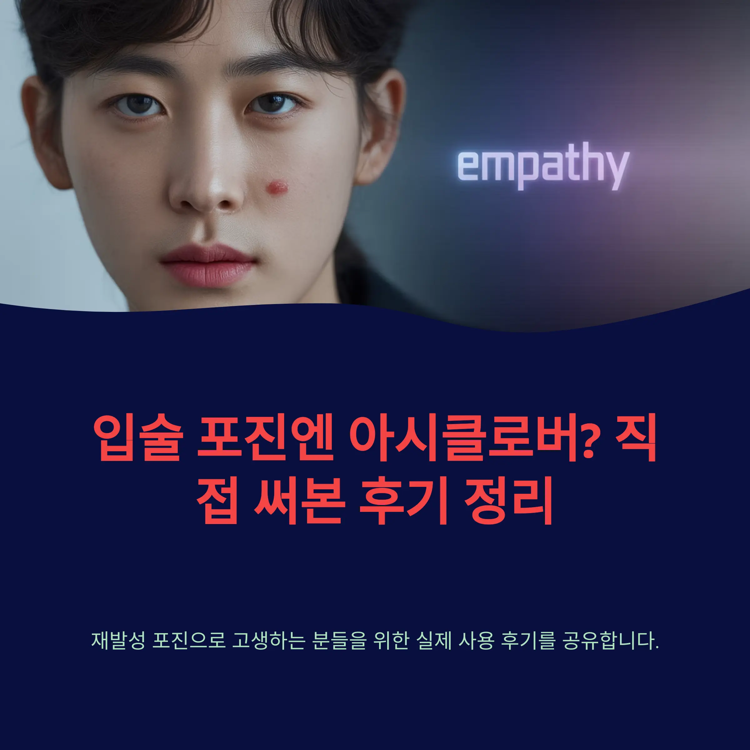 입술 포진엔 아시클로버? 직접 써본 후기 정리