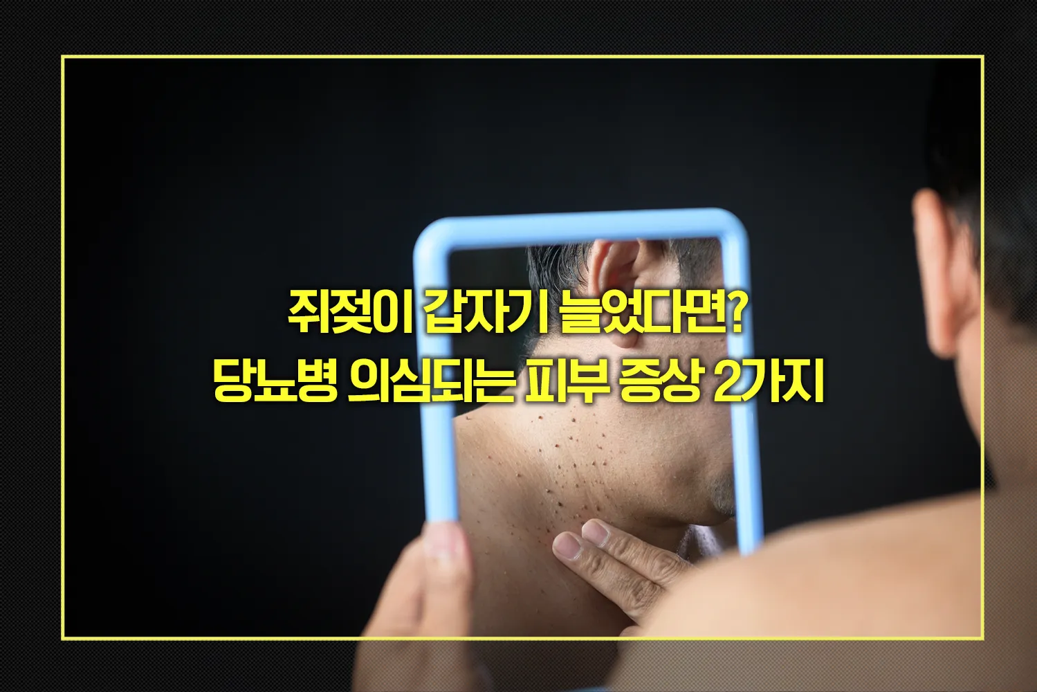 당뇨병_의심_피부증상