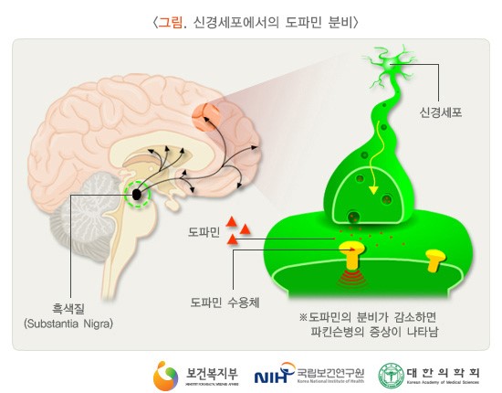  노인 질병 - 도파민과 파킨슨병