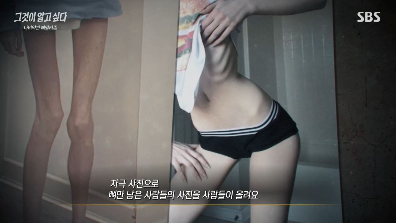  그것이알고싶다 나비약 위험성 부작용, 뼈말라족 정리