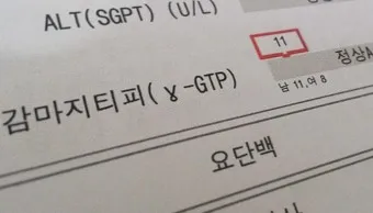 감마지피티 높으면 수치 정상화_6