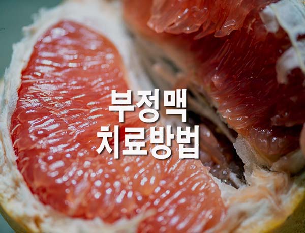  부정맥 치료방법(+좋은 음식)