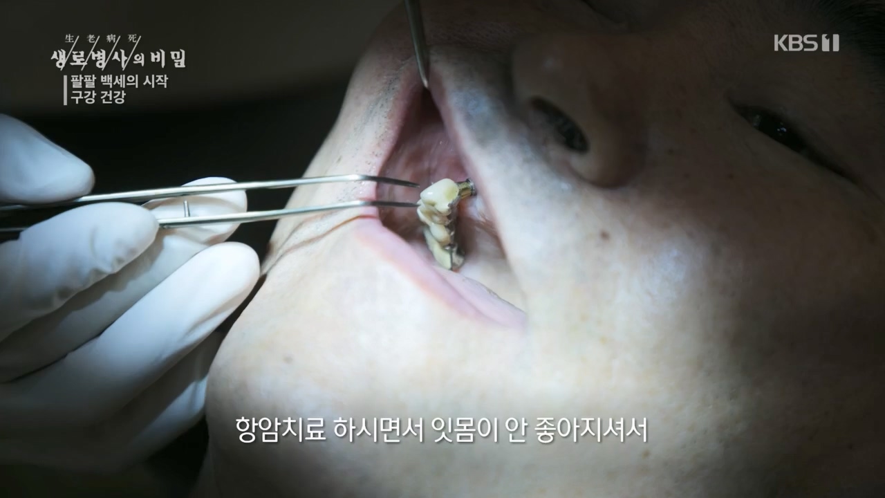 생로병사의 비밀.E894.240118p.H264-F1RST.mp4_20240118_195342.406.jpg