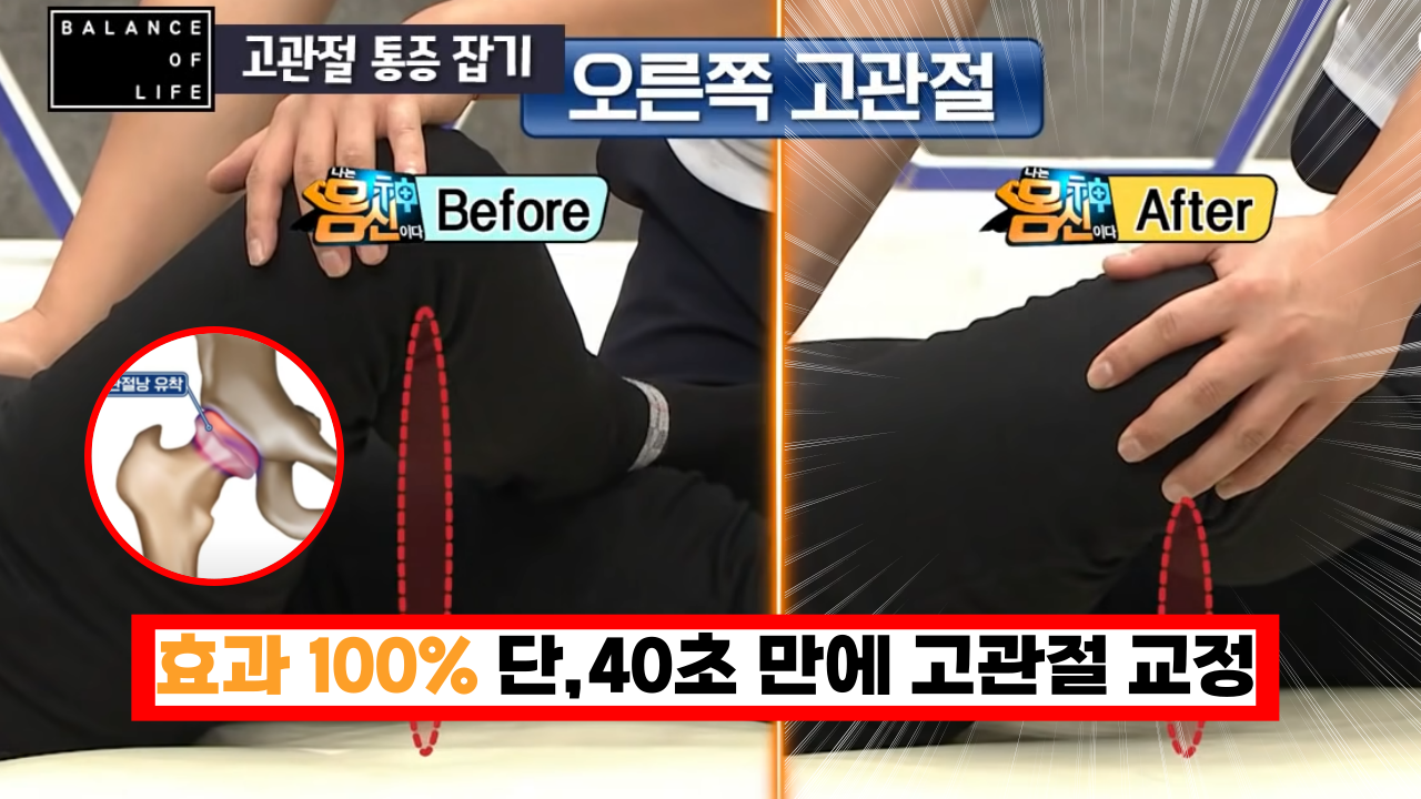 '그냥 영상보고 따라 했는데 효과가 대박' 단 40초만에 고관절 완벽히 교정하는 방법