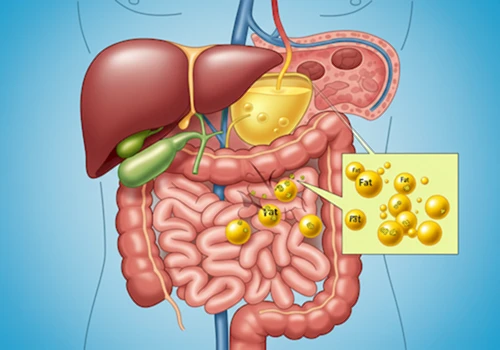 인체 내부에서 간&amp;#44; 담도&amp;#44; 소화기관을 단순화하여 보여주며&amp;#44; 간 기능 저하로 담즙 분비가 원활하지 않아 지방 소화가 제대로 이루어지지 않는 과정을 묘사한 개념적인 디지털 일러스트레이션