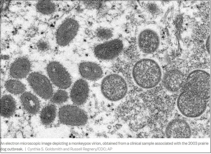  코로나 끝나가니 이제 원숭이 천연두?..."유행 비상"  VIDEO: Why monkeypox isn’t like Covid-19