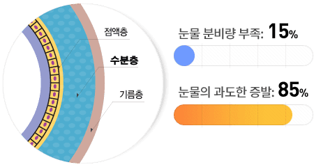 눈물층의 구성과 안구건조증 원인 (출처 : 삼성안과 topeye.co.kr)