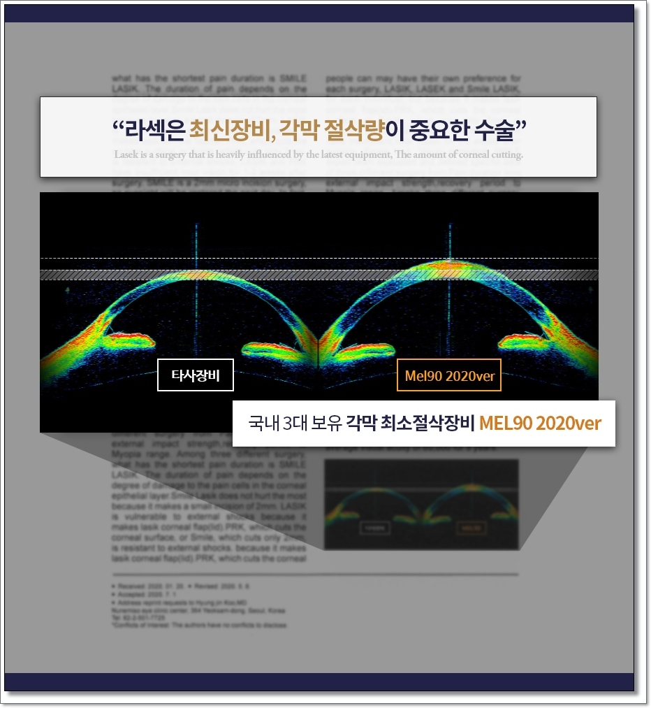 라섹회복기간 1일 11