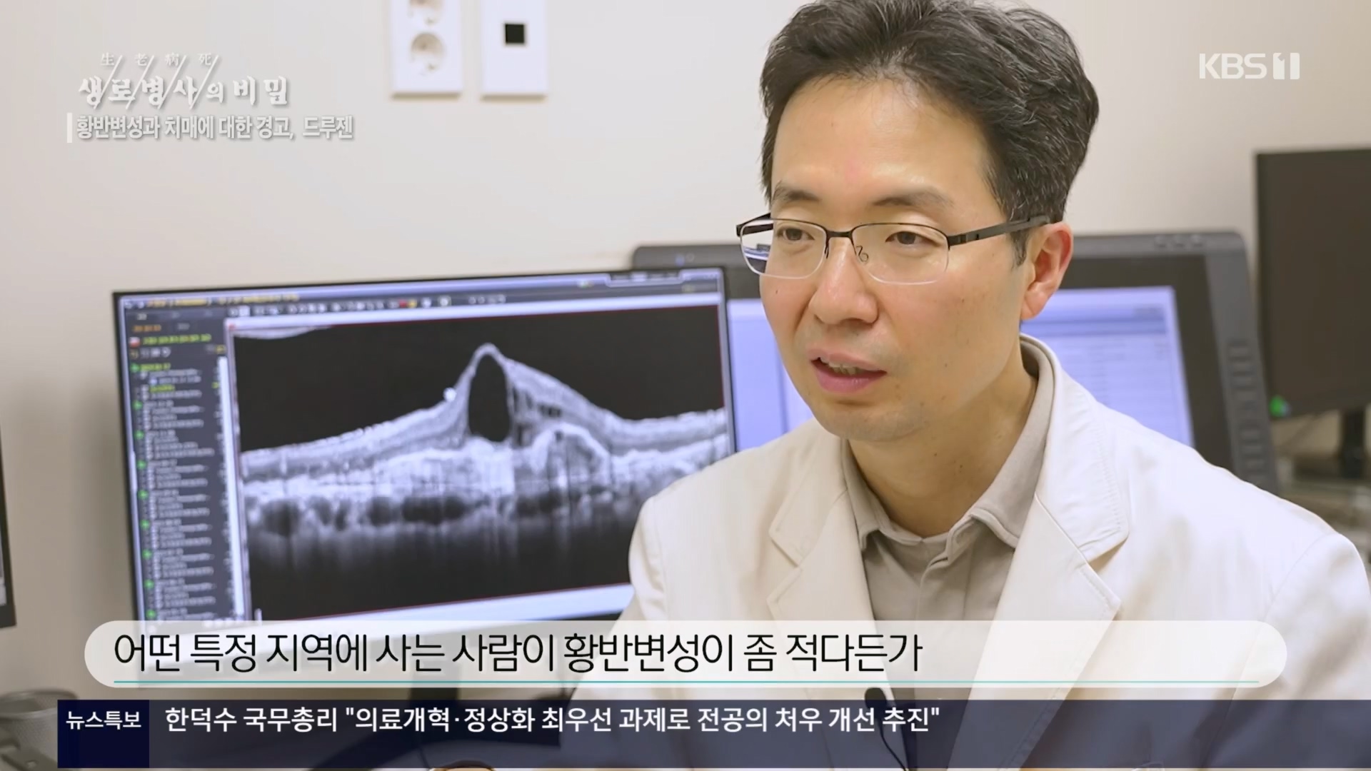 생로병사의 비밀.E899.240228p.H264-F1RST.mp4_20240229_202537.435.jpg