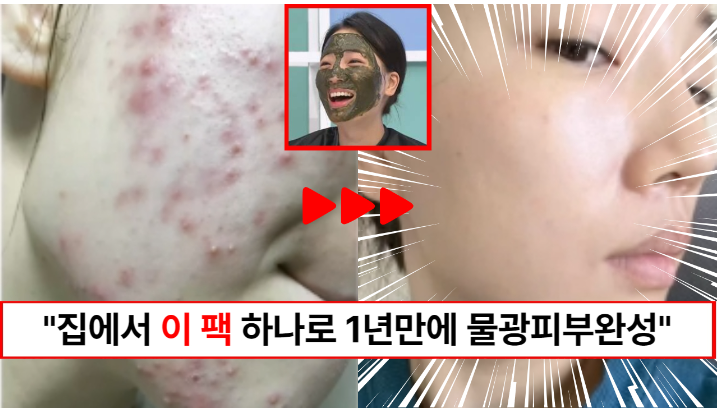 “이 가루팩 하나면 됩니다” 울긋불긋 멍게피부에서 1년만에 물광피부가 될 수 있었던 돌고래팩 만드는법 “이 가루팩 하나면 됩니다” 울긋불긋 멍게피부에서 1년만에 물광피부가 될 수 있었던 돌고래팩 만드는법