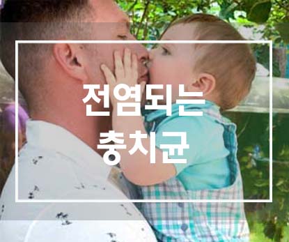  어른 입에서 아이 입으로 전염되는 충치균