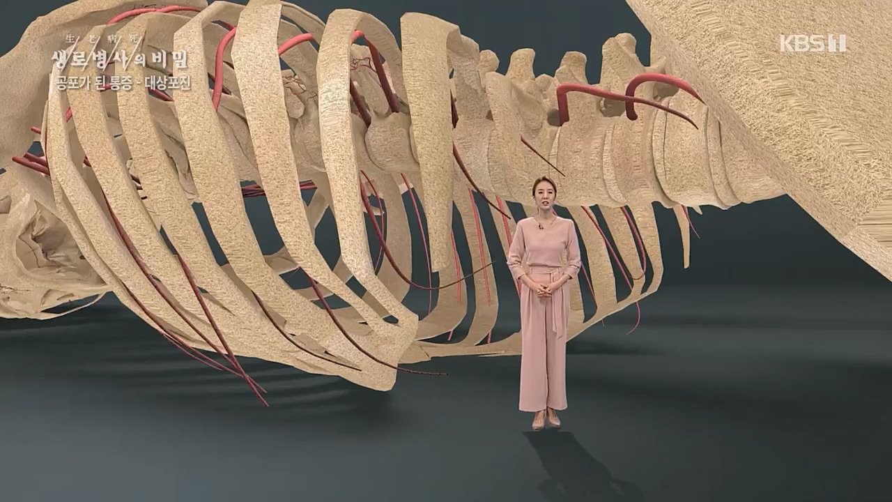 생로병사의 비밀.E857.230223p.H264-F1RST.mp4_20230223_202248.870.jpg