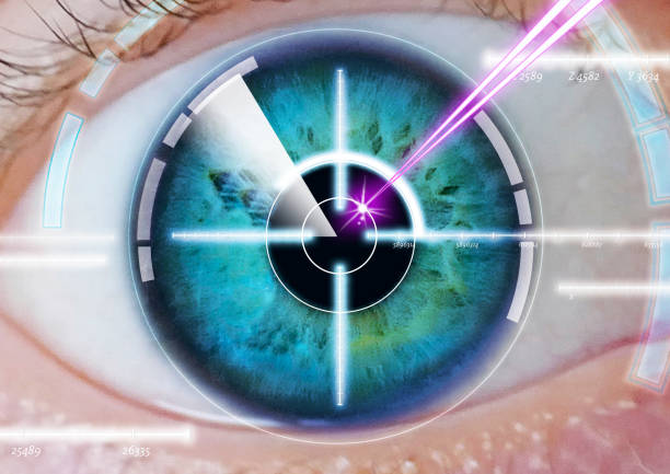 눈-레이저-치료
