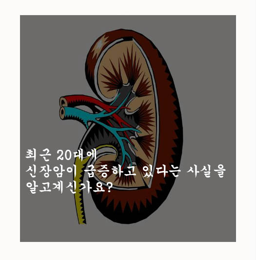  최근 20대에 신장암이 급증하고 있다는 사실을 알고계신가요?