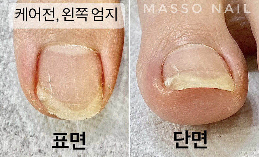 은영신발 이미지