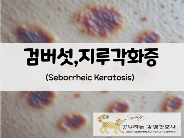 성인간호_지루각화증(검버섯, Seborrheic Keratosis) 원인, 치료, 홈케어 방법 알아보기