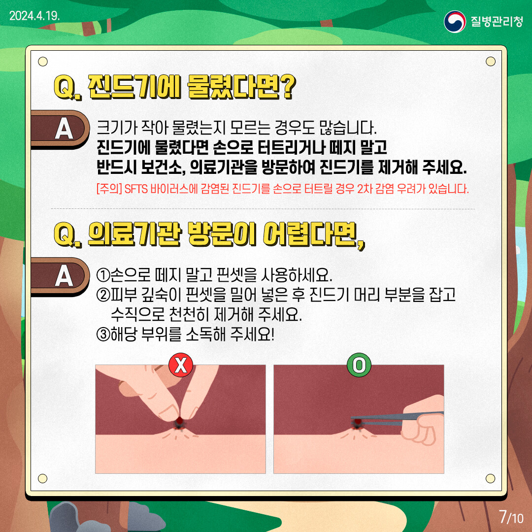 진드기에 물렸다면