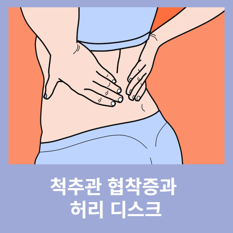 척추관-협착증과-허리-디스크