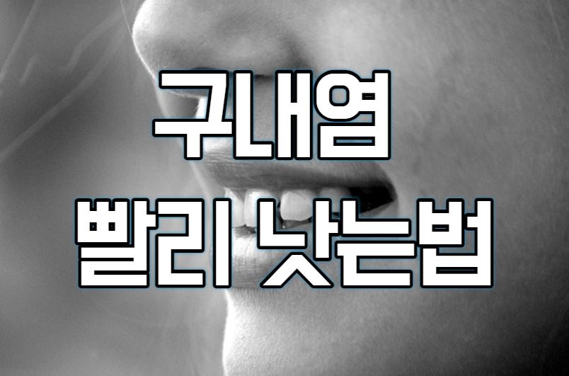 구내염 빨리 낫는법