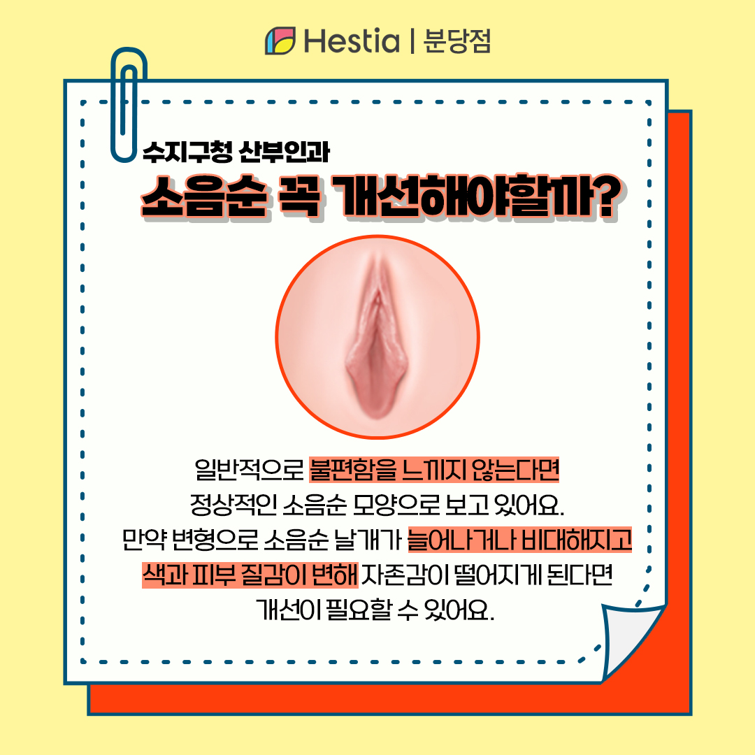 수지구청 산부인과 소음순성형사진 회음부성형 회음부수술 소음순 왜 개선하나요?