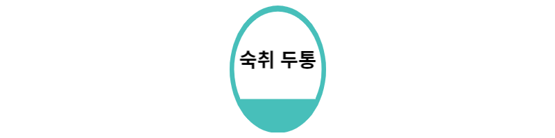  숙취 두통 해소 원인과 좋은음식 5가지