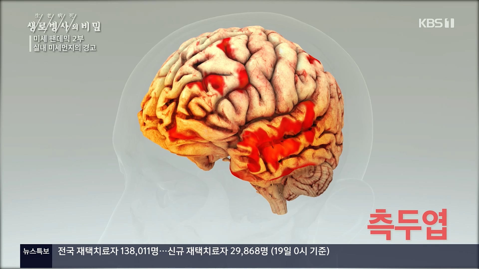 생로병사의 비밀.E840.221019p.H264-F1RST.mp4_20221020_180928.913.jpg