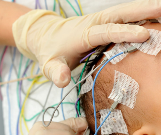신생아 뇌파검사 EEG