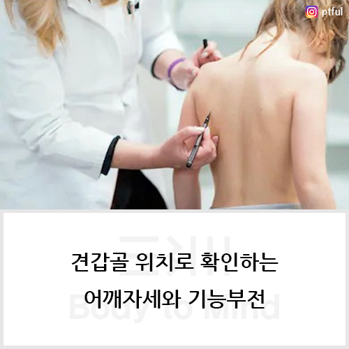  견갑골 위치(scapula position)로 확인하는 어깨자세(shoulder position)와 기능부전(dysfunction)