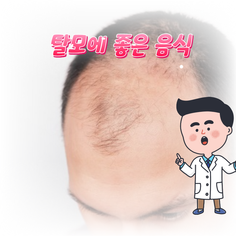  머리숱이 풍성해지는 탈모에 좋은 음식
