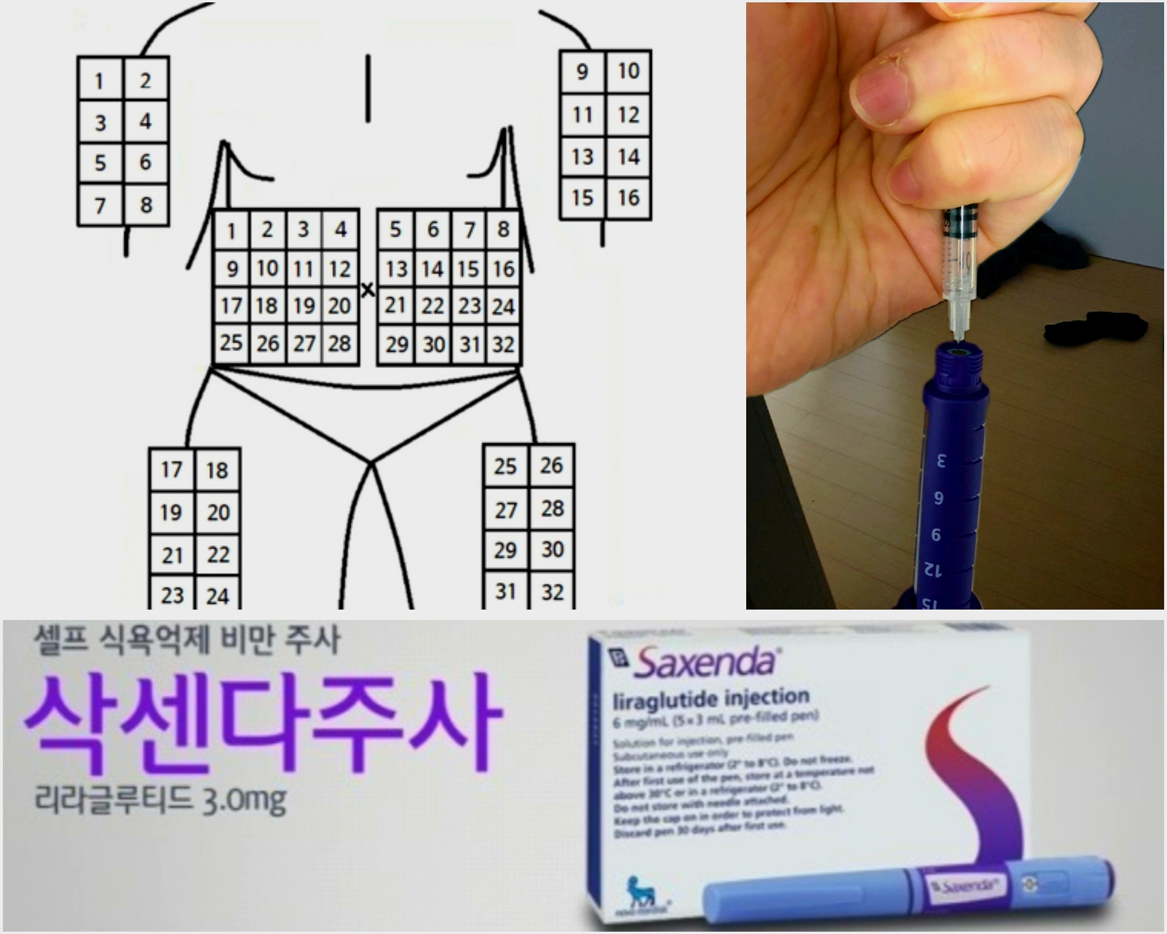 삭센다 주사 부위