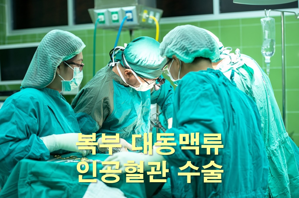  복부 대동맥류 인공혈관 수술과 복부 대동맥류 검사 방법