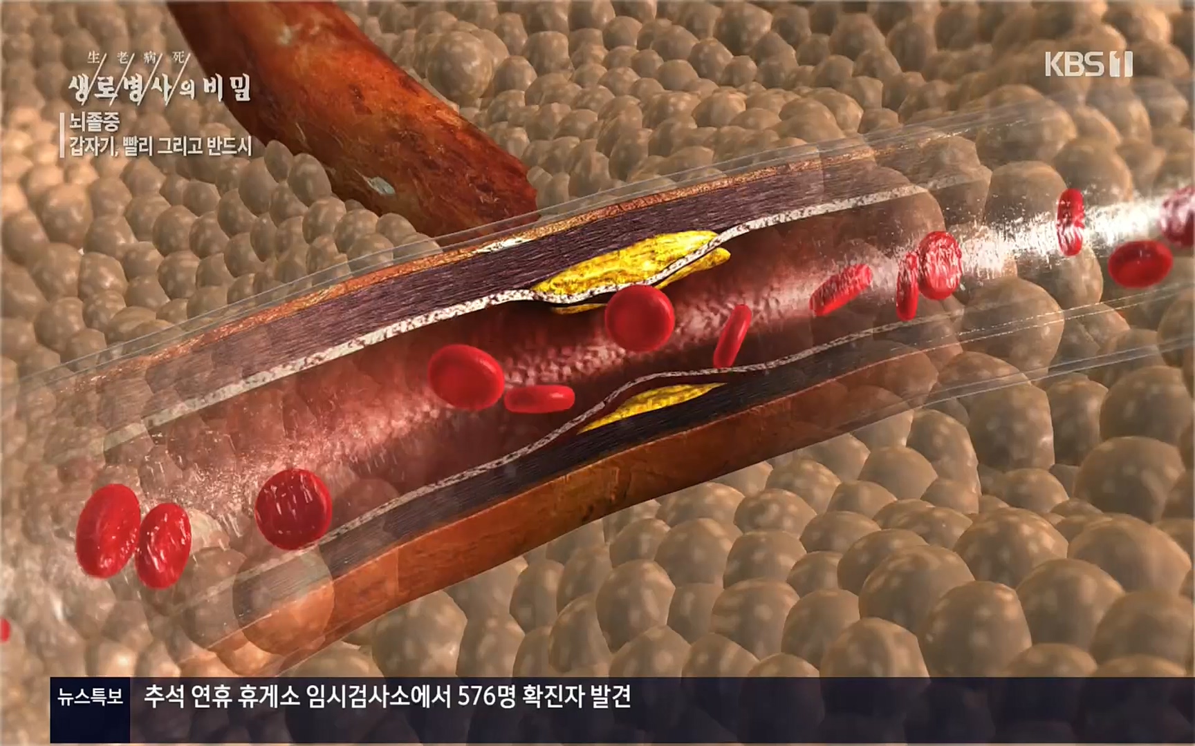 생로병사의 비밀.E835p.H264-F1RST.mp4_20220917_181733.168.jpg