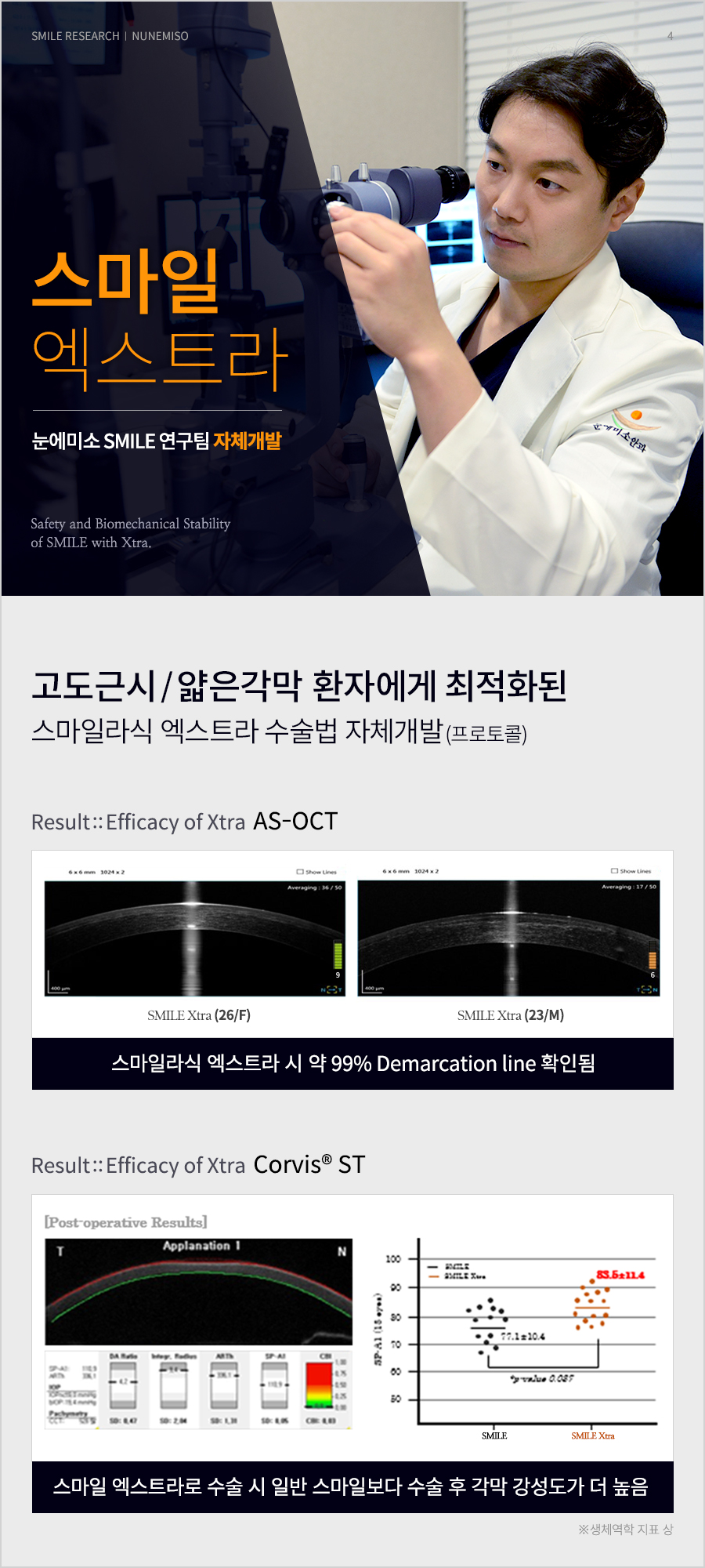 (국내 사례) 스마일라식회복 결과 4