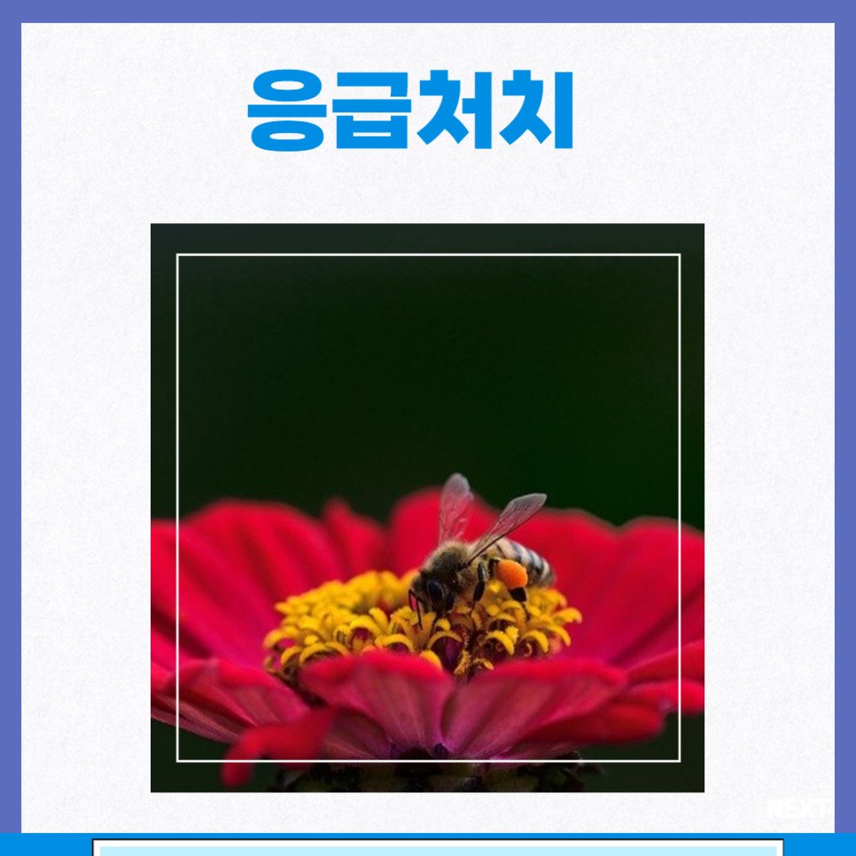 벌에 쏘였을때 응급처치 대처방법