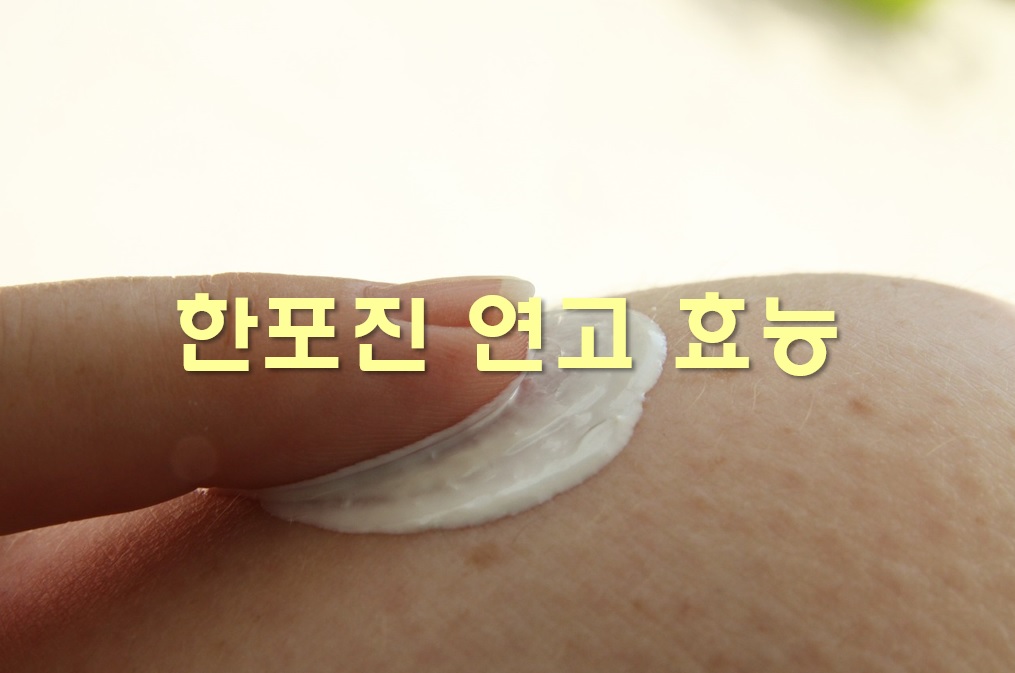  손바닥 한포진 치료 방법과 연고 효능