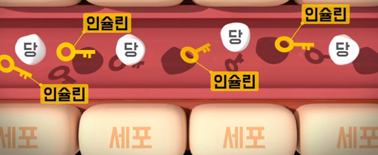 당뇨병의 초기 증상