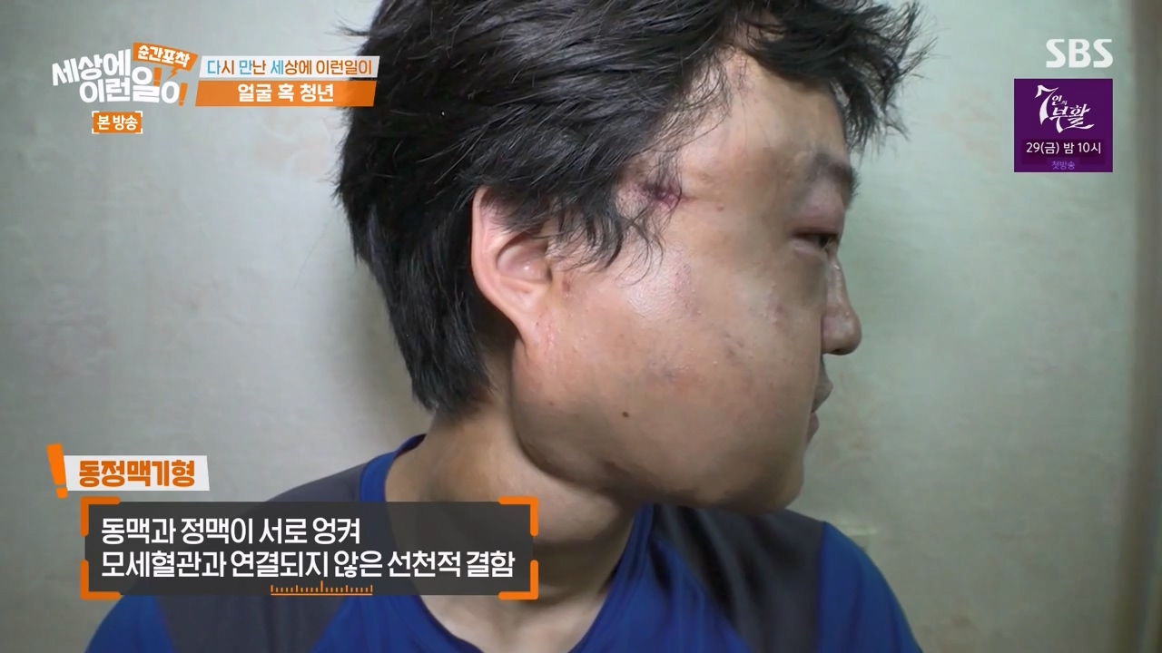 순간포착 세상에 이런일이.E1269.240317p-NEXT.mp4_20240317_162931.228.jpg