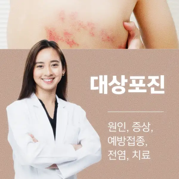 대상포진 원인, 증상, 예방접종, 전염, 치료