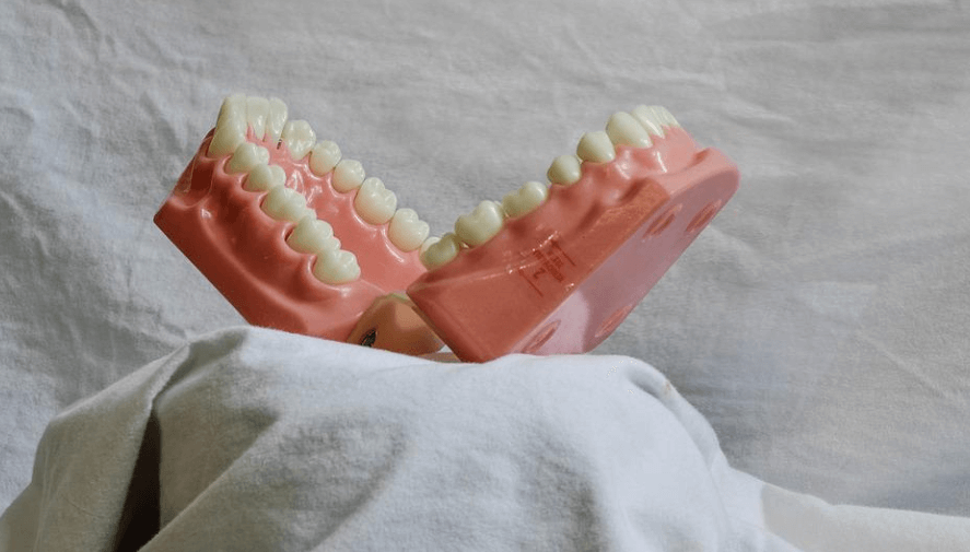 치아 구조 조형물