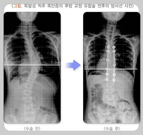 수술 전후 사진